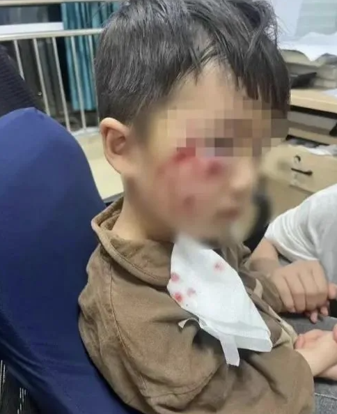 被瘋?cè)麤](méi)有“救命藥”，怎么辦？